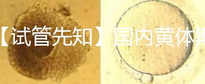 【試管先知】國(guó)內(nèi)黃體期方案經(jīng)驗(yàn)緊缺,2點(diǎn)促排弊端需了解
