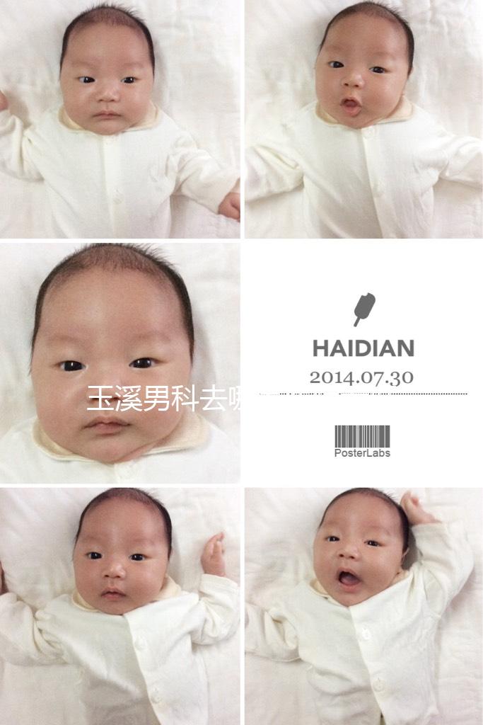 玉溪男科去哪家醫(yī)院看好，怎么選攻略，這個排行榜不要錯過