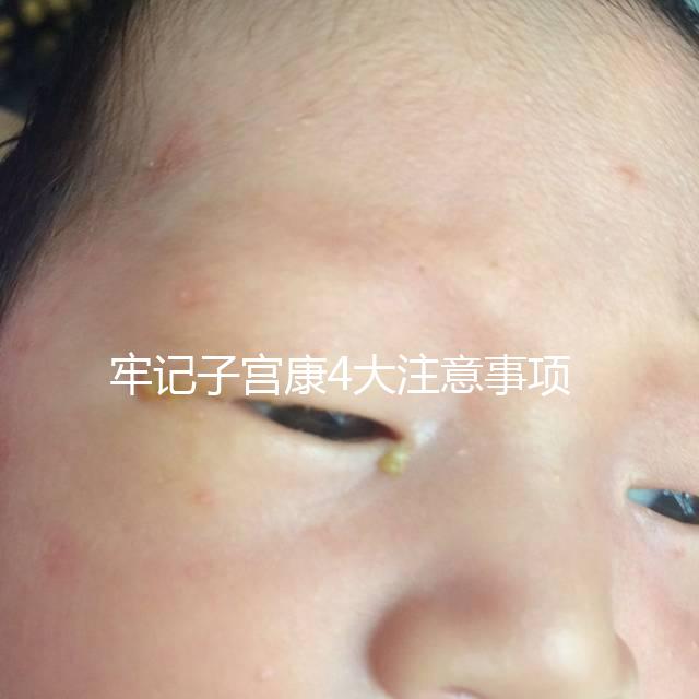 牢記子宮康4大注意事項，輕松避免胃脹、腹瀉等副作用