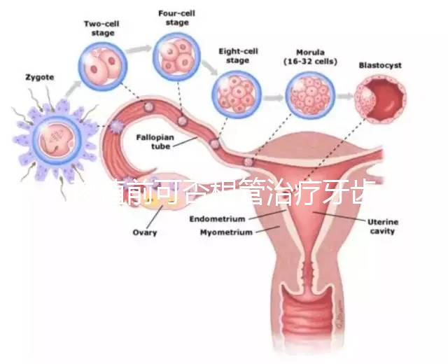移植前可否根管治療牙齒看情況，這些影響別還不知道