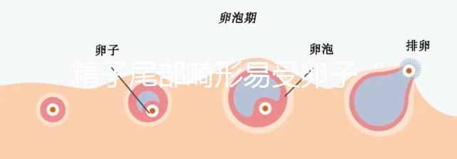 精子尾部畸形易受卵子“嫌棄”，無尾、短卷尾需重視