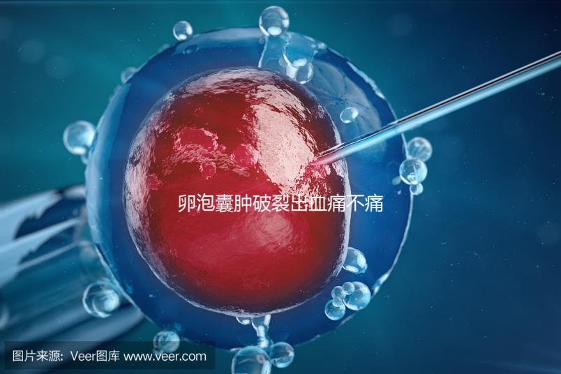 卵泡囊腫破裂出血痛不痛？經歷過的姐妹們給出回應