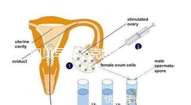卵巢早衰，克齡蒙和芬嗎通藥物選擇引爭議