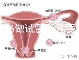 去青島做試管嬰兒要多少錢？