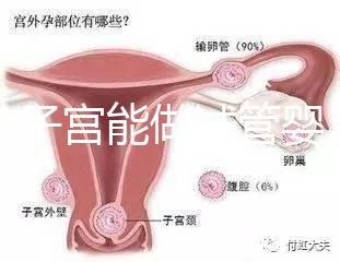 雙角子宮能做試管嬰兒嗎？可以，但這2大條件缺一不可