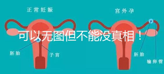 可以無圖但不能沒真相!段濤大夫帶你了解B超檢查報(bào)告單