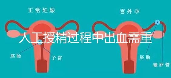 人工授精過程中出血需重視！這3種情況會(huì)影響成功率