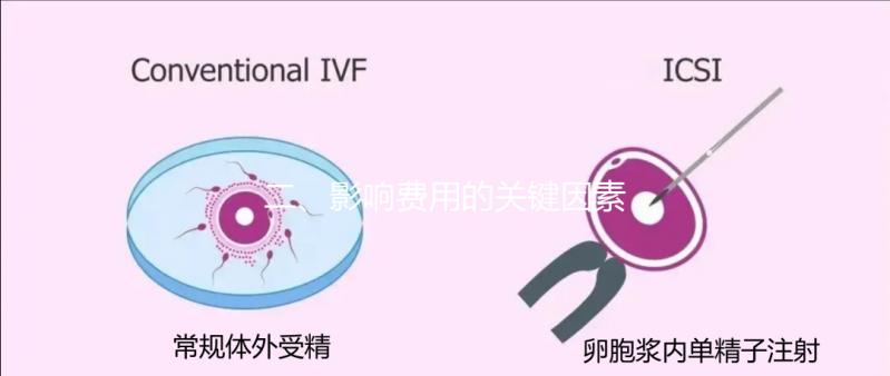 二、影響費用的關鍵因素