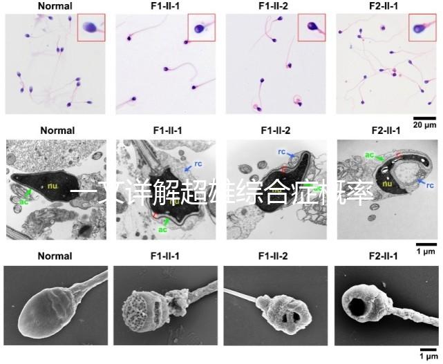 一文詳解超雄綜合癥概率有多大，想造的人多不多看過來