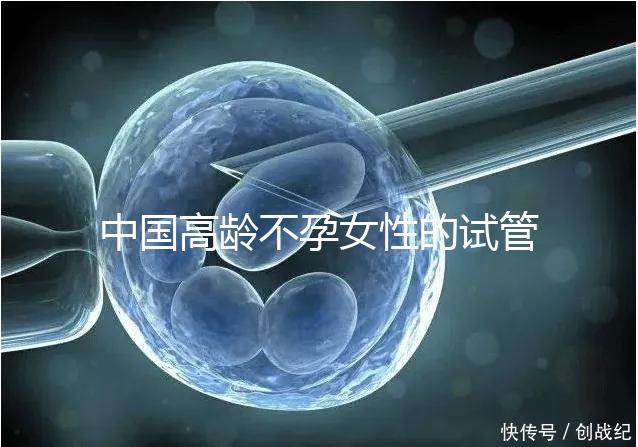中國高齡不孕女性的試管嬰兒指南，8個方面5條推薦意見