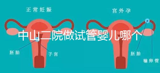 中山二院做試管嬰兒哪個(gè)醫(yī)生好？附醫(yī)院試管成功率