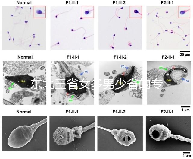 東北三省女多男少省的專(zhuān)業(yè)解讀原因1:1真沒(méi)開(kāi)玩笑