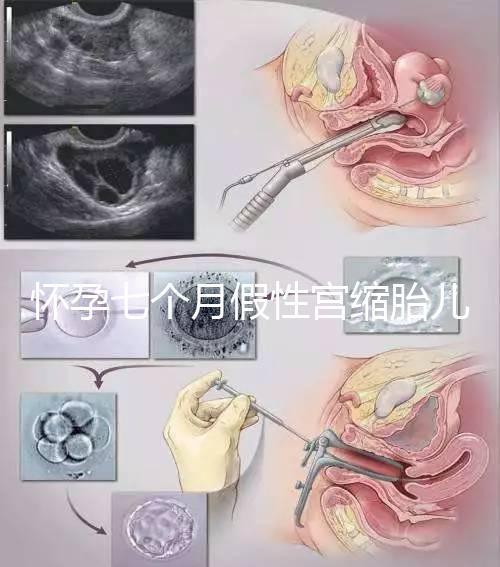 懷孕七個月假性宮縮胎兒可能缺氧，處理不好對胎兒影響大