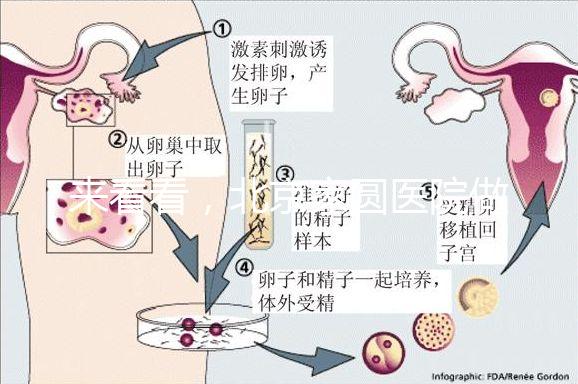 來看看，北京家圓醫院做三代試管費用總共多少？