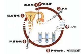 文昌哪里能做試管嬰兒？國內做一次成功率有多高？