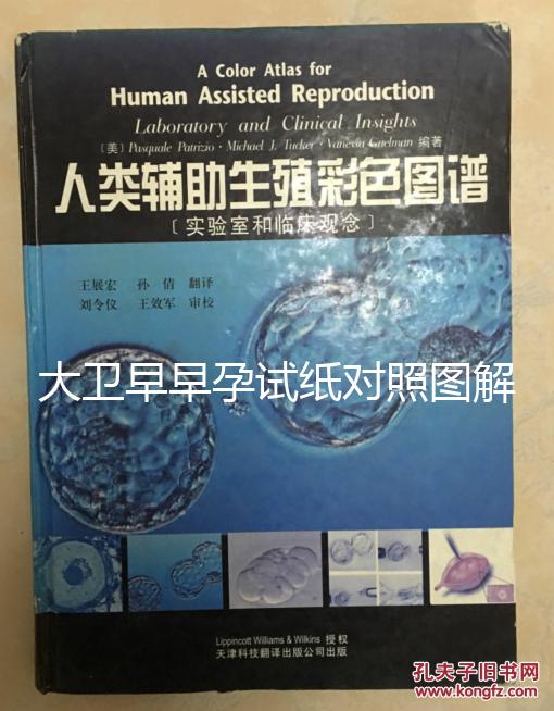 大衛(wèi)早早孕試紙對(duì)照?qǐng)D解,教你怎么看結(jié)果是不是陽(yáng)性