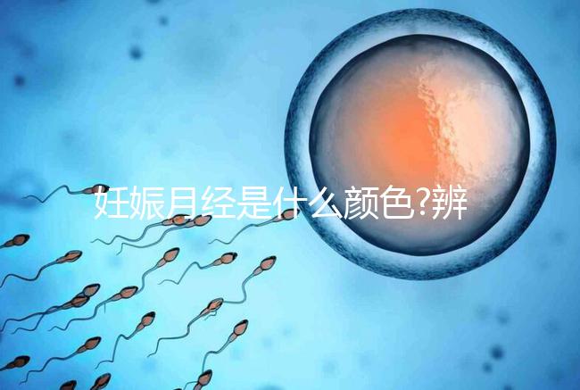 妊娠月經是什么顏色?辨別其與月經區別3大要素之一