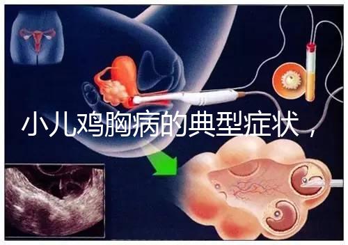 小兒雞胸病的典型癥狀，早發(fā)現(xiàn)早治療很重要！