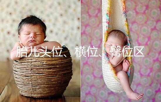 胎兒頭位、橫位、臀位區(qū)別大,5個(gè)方面教你分辨