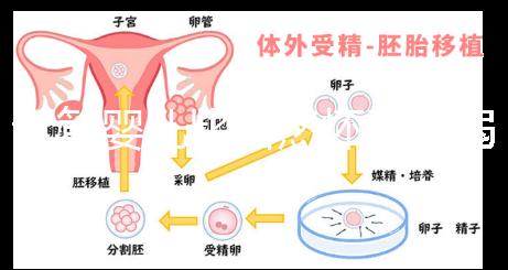 試管嬰兒比自然懷孕脆弱原因來襲，正不正常三分鐘說清