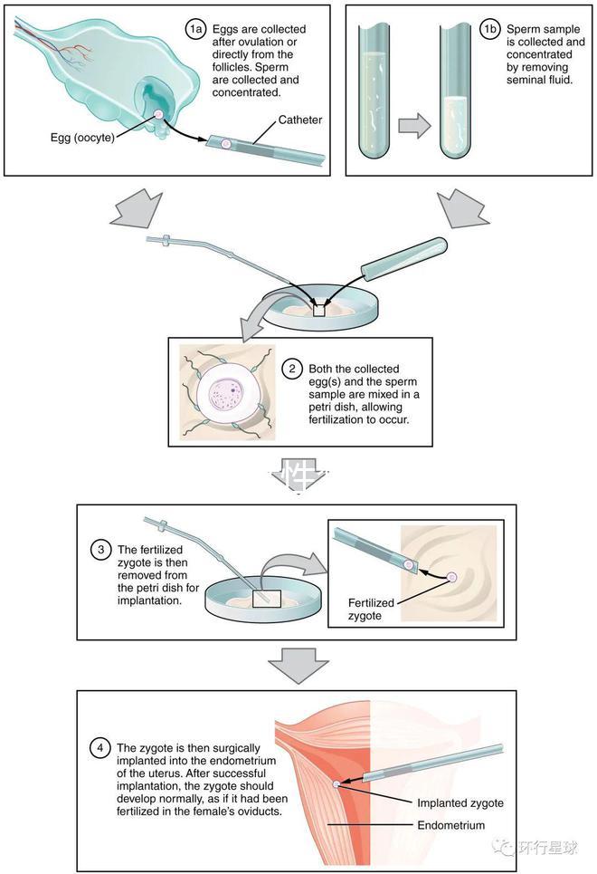 貴陽單身女性禁止凍卵？持“三證”已婚女性就能凍卵