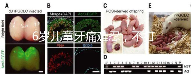 6歲兒童牙痛難忍，不打針吃藥5個小妙招快速止疼