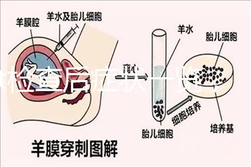 tct檢查后癥狀一覽,專家提醒做好處理措施是關(guān)鍵